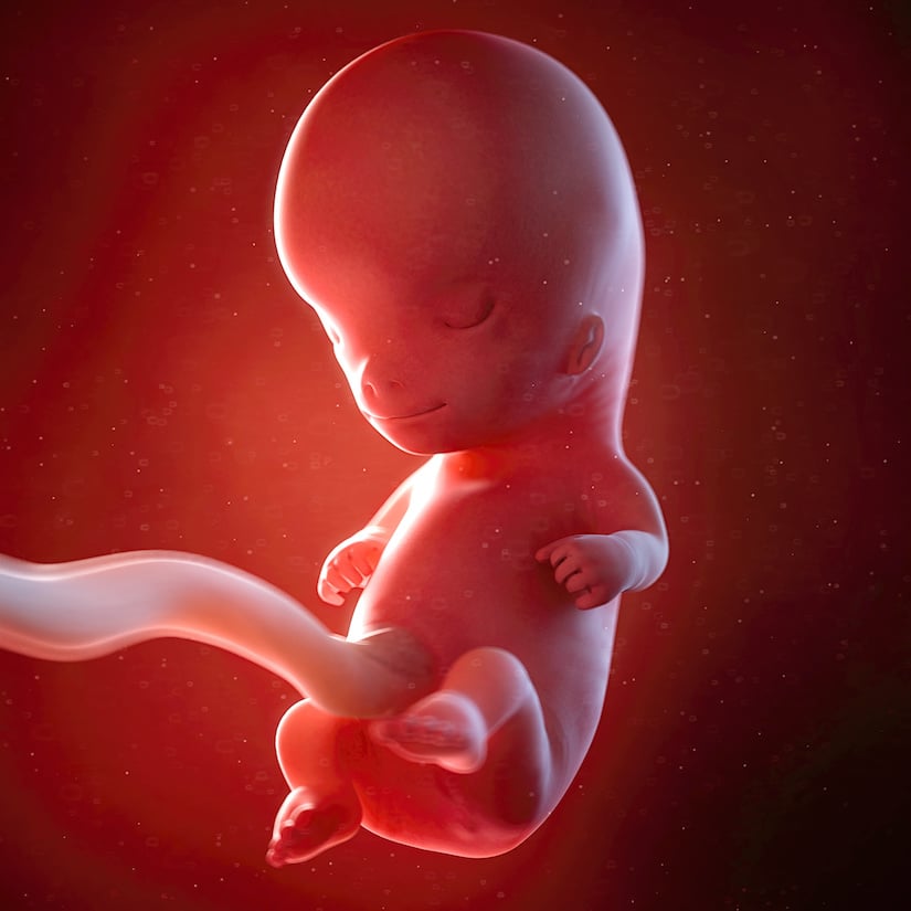 Baby at 10 weeks old deals in womb